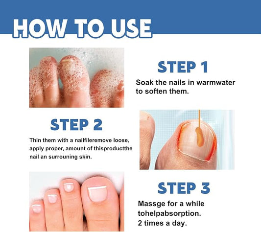 Crema para el tratamiento de hongos en las uñas - additional image 1