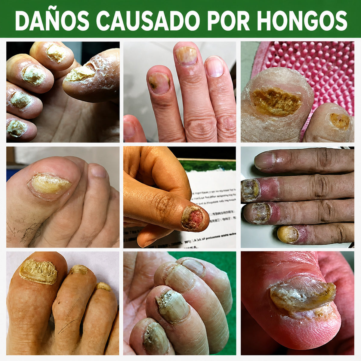 Unas con aspecto deteriorado