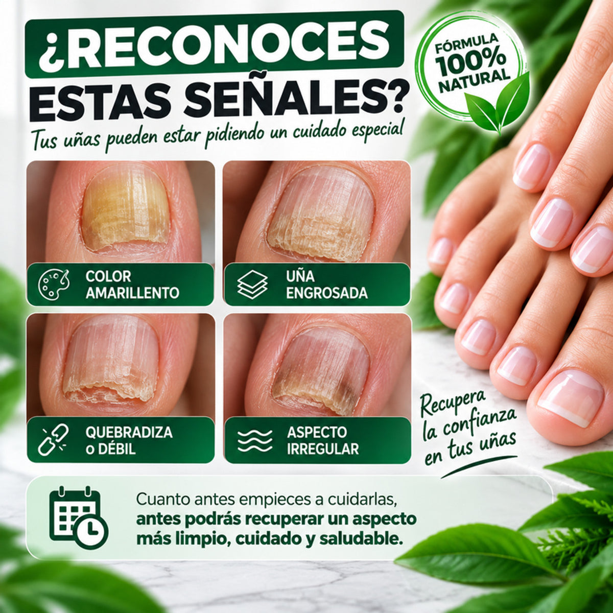Senales: una amarillenta, engrosada, quebradiza o irregular